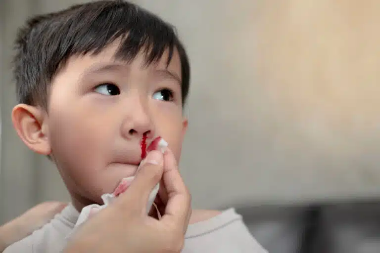 bloedneus bij een peuter